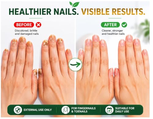 Nail Treatment 0.5oz - Healthy Nails Formula with Brush Applicator