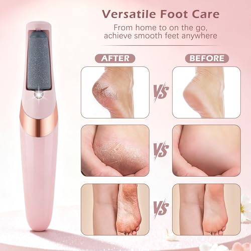 Rechargeable Electric Callus Remover for Smooth Feet - 2 Gears & 2 Rollers
