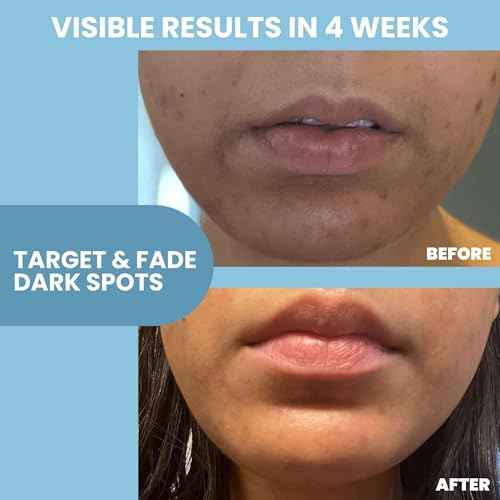 Eva Naturals Niacinamide Serum for Face with Zinc PCA & Botanical Hyaluronic Acid ? Pore Minimizer, Dark Spot & Redness Relief, Skin Tone & Texture Support ? Lightweight Cream Alternative (1 oz)