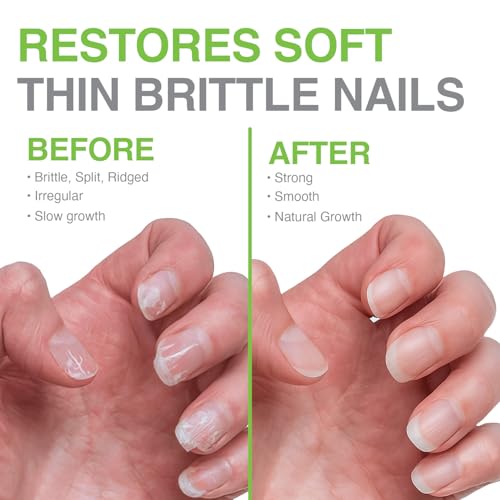 Probelle Nail Hardener Formula 1: Extra Strong Base Coat for Weak Nails