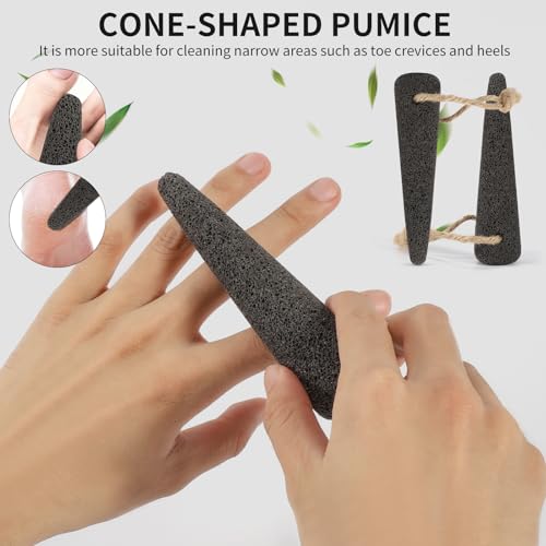 ÖkoStamm 4-Piece Natural Volcanic Pumice Stone Set for Feet Callus Removal