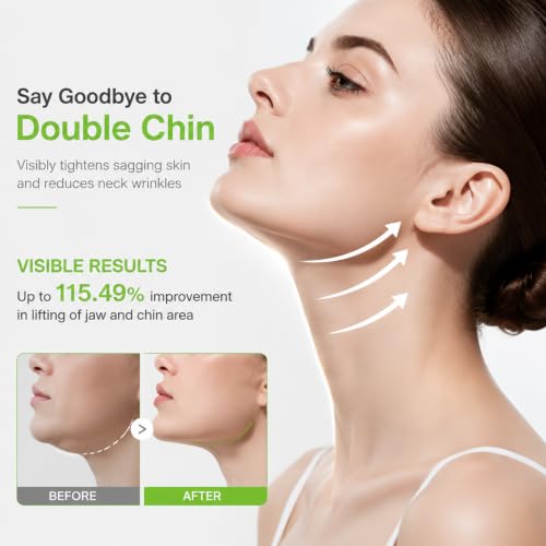 V Lifting Chin Mask with Collagen & Cactus Extract (4 Pack)