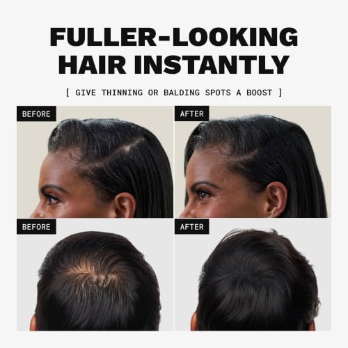 Toppik Hair Building Fibers Dark Brown 0.97oz - Thinning Hair Concealer & Fuller Look