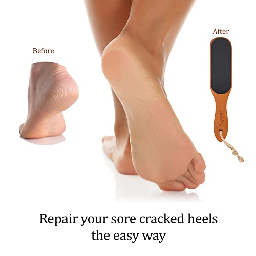 Pumice Valley Wooden Pumice Stone Foot File for Callus & Dead Skin
