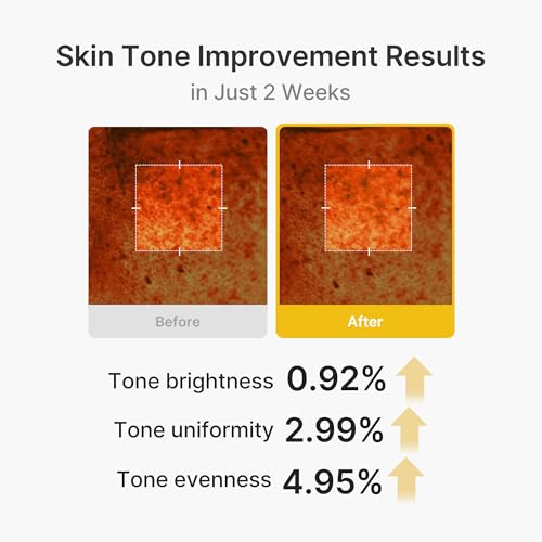 Medicube Capsule Cream with Kojic Acid & Turmeric for Uneven Skin Tone - 1.86 oz