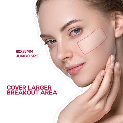 Epielle Acne Patch Over-Zit All Over Face 84 counts + 138 counts more dots