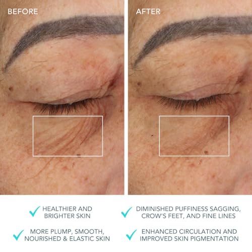 FOREO Bear Microcurrent Facial Device - Face Lift & Toning