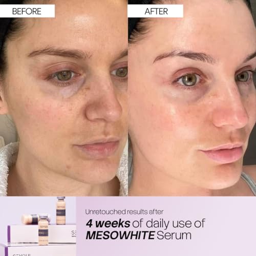 Meso White Facial Serum Ampoules ? Uneven Tone Appearance & Skin Radiance Support with Niacinamide, Stem Cells & Collagen ? 6 Vials (0.17 fl oz Each)