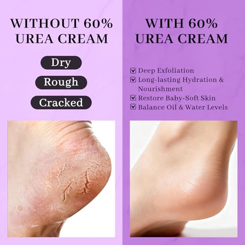 60% Urea Cream with 2% Salicylic Acid - Callus Remover Foot Cream (150g)