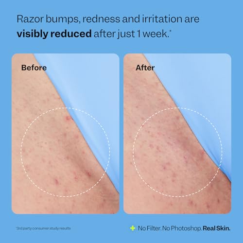 Peach Slices Ingrown Hair Treatment Roller - 1.69 oz
