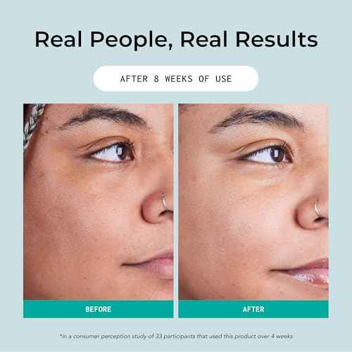 Hydrating Gel Cleanser, Face Wash with Hyaluronic Acid & Vitamin C for All Skin Types, Daily Skin Care, Makeup Remover for Women, Facial Cleanser, Vegan & Cruelty Free