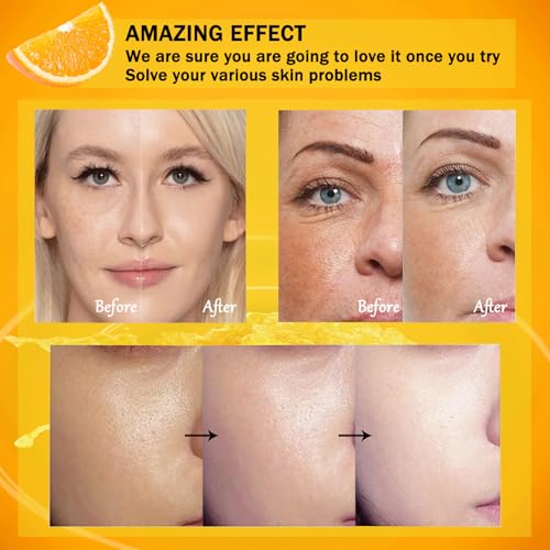 Moisturizing Face Skin Care Gift Set for Women Girls (Vitamin C)