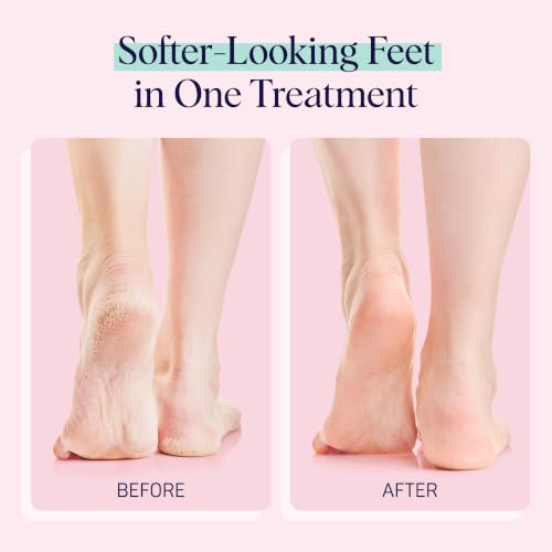 SpaLife Moisturizing Foot Mask Booties for Dry Cracked Feet - 8 Pack