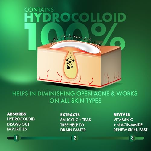 Urban Yog Acne Pimple Patch - 72 Hydrocolloid Stickers