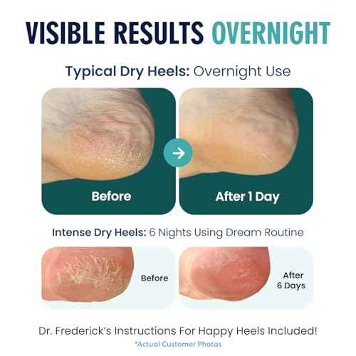 Dr. Frederick's Original Moisturizing Heel Socks for Dry Cracked Heels Treatment - Infused with Olive Oil, Aloe Vera Oil and Vitamin E - 2 Pairs - Stocking Stuffers for Adults - Green Aloe