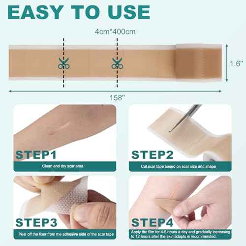 Silicone Scar Sheets, Silicone Scar Tape(1.6"x 158"), Scar Tape for Scar Removal Treatment, Reusable Silicone Scar Strips for Surgical, C-Section, Keloid, Burn, Acne, Surgical Scars