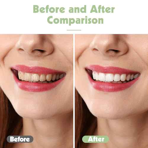 6pcs Travel Toothbrush Set, Extra Soft Toothbrushes for Adults Gentle Portable Manual Toothbrush with Individual Travel Case Deep Cleaning Flossing Toothbrushes for Sensitive Teeth(Multicolor)