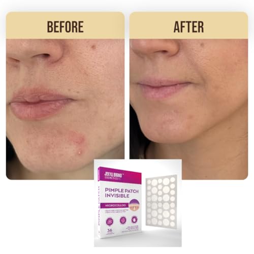 Premium Pimple Patch (36 counts) | Jekyll Brand Cosemtics¢â | Hydrocolloid | Invisible | Acne Patch for Covering Zits and Blemishes | Sterile Spot Patches for Face and Skin | Dermatologist Approve
