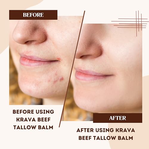 Beef Tallow for Skin, Beef Tallow for Face, Whipped Tallow Balm, Beef Tallow Moisturizer - Tallow Face Moisturizer, Tallow Cream | 100% Grass Fed, Unscented, 2 oz