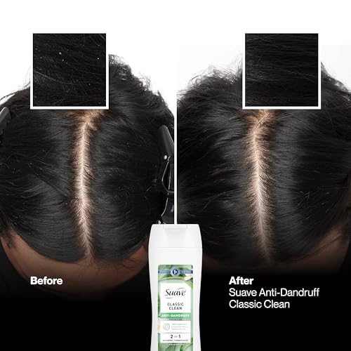 Suave Anti Dandruff 2-in-1 Shampoo & Conditioner, 12.6 FL OZ