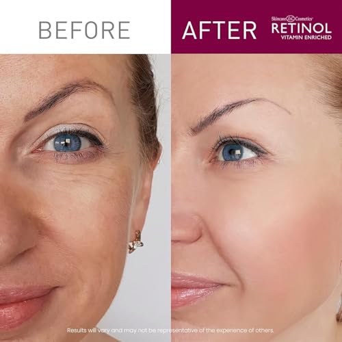 LIVAURA Retinol Cream Cleanser Anti-Aging ? 5oz ? Daily Deep Cleansing Facial Wash Improves Skin Texture, And Exfoliates for Softer Face ? Renewing Vitamin A Minimizes Wrinkles and Fine Lines