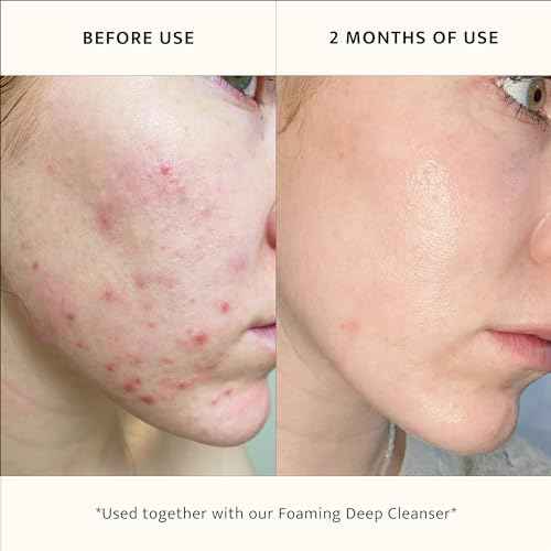 Lemon & Beaker Pore-Reducing Toner - Alcohol-Free, Vegan Face Toner for Soothing & Hydrating Skin, Minimizes Large Pores, 3.5 fl oz, Made in New Zealand