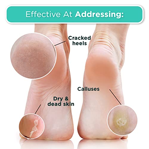 DERMORA Foot Peel Mask - 4 Pack of Regular Size Skin Exfoliating Foot Masks for Dry, Cracked Feet, Callus, Dead Skin Remover for Baby Soft Feet, Original Scent