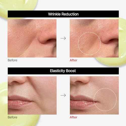 Dr.Different VITALIFT-A Forte Retinal 0.1%, Intensive Anti-Aging Cream for Wrinkle Reduction, Skin Elasticity, Lifting, Firming with Vita A, K-Skincare made by Korean Dermatologist. 0.7oz