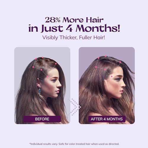 Women's 5% Minoxidil Spray for Hair Growth - 2-Pack
