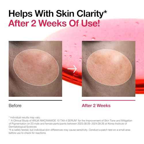ANUA Niacinamide 10 + TXA 4 Serum, Hyaluronic Acid, Tranexamic acid, Facial Serum For GlassSkin, Cardi B¡¯s Pick, Glow Back Serum, Dark Spot Care, Postnatal Skincare, Korean Skincare (30ml/1.01 fl.oz)