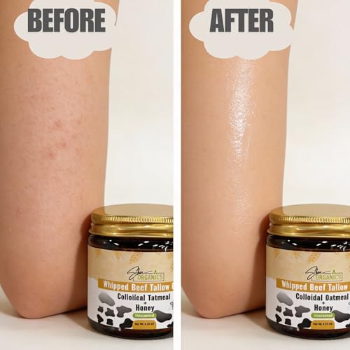 Shea Organics Whipped Beef Tallow Balm for Face & Body | 100% Grass-Fed Tallow with Colloidal Oatmeal & Honey | Unscented Moisturizer for Sensitive, Eczema-Prone & Rosacea-Prone Skin | 4.23 oz