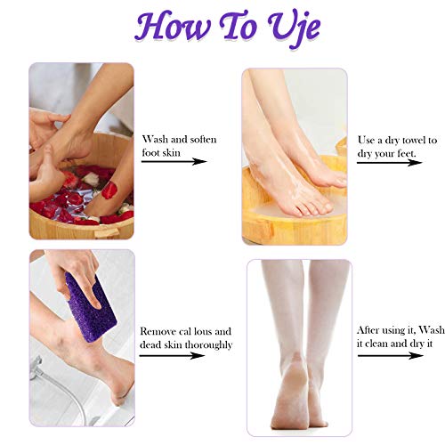 40 Pcs Pumice Stones for Feet - Callus Remover and Foot Scrubber