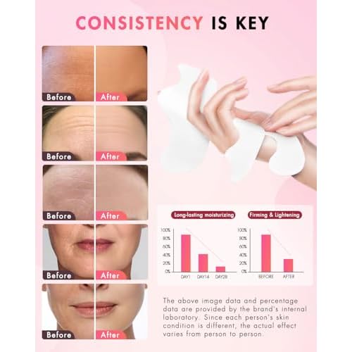 Forehead Wrinkle Patches & Smile Line Patches, Overnight Facial Wrinkle Treatment with Hyaluronic Acid, Aloe, Collagen & Vitamin E to Lift Smile Lines for Women 36pcs with Face Retinol Cream