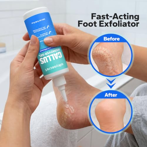 SilkySecret Callus Remover Gel for Feet - Extra Strength Foot Softening & Cracked Heel Treatment