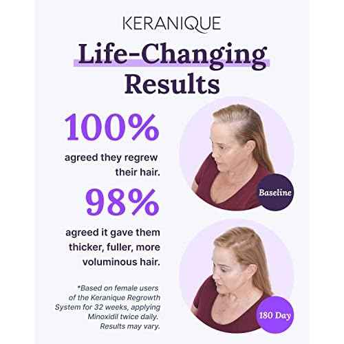 Keranique Hair Regrowth Treatment for Women - 2% Minoxidil for Women Hair Growth & Thickening - Topical Solution Scalp Treatment for Hair Loss & Thinning w/Precision Spray Applicator - 4 Fl Oz