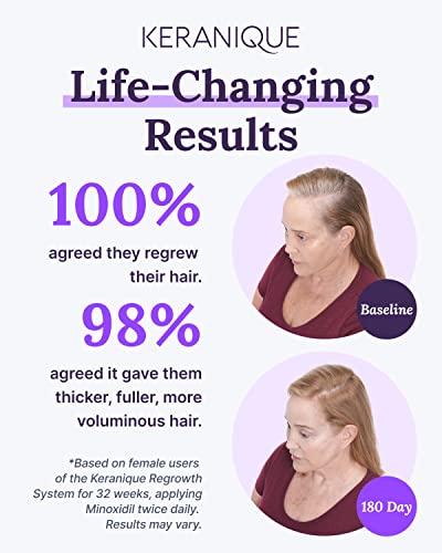 Keranique 2% Minoxidil Hair Regrowth Treatment for Women