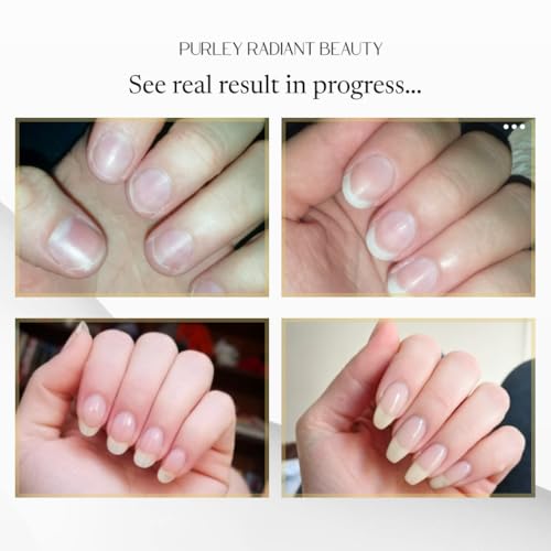 Purely Radiant Natural Nail Growth & Cuticle Oil Pen (3ml) - Hydrating Serum