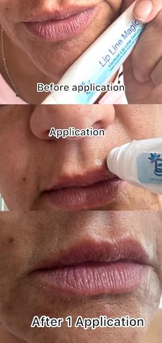 Lip Line Serum with Hyaluronic Acid & Papaya Extract