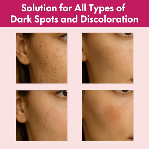 Arbutin 7% + Tranexamic Acid 4% Face Cream for Dark Spots & Uneven Skin Tone ? Hydrating, Non-Irritating, Safe for Sensitive Skin 1.76 oz (Pack of 1)