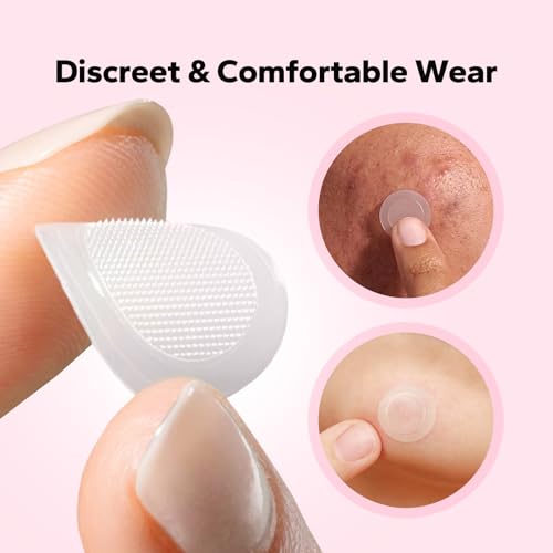 Pimple Patches for Face (18 Count), Microdart Acne Patches, Hydrocolloid Blemish Spot with Salicylic Acid, Fast-Acting for Early Stage Deep Pimples, Zits, Breakouts & Cystic Acne