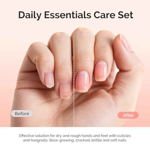 MelodySusie 25ML Cuticle Care Kit - Cuticle Oil and Cuticle Remover, Cuticle Nourishes and Softener, Promotes Nail Growth and Strength for Home and Salon Use 2PCS