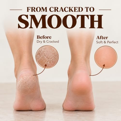Beauticone Terra Glow Natural Terracotta Pumice Stone for Feet - Dual Sided Callus Remover & Foot Exfoliator