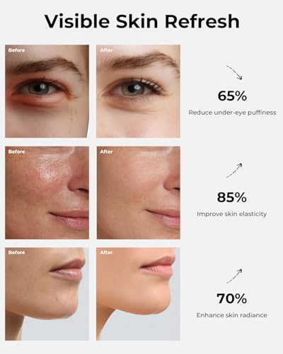 Cold & Heat Eye Depuffing Wand for Face Puffiness