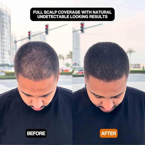Hair Filler Powder - Instant Volume & Scalp Coverage Black