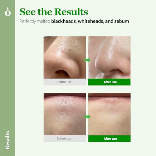 ONGREDIENTS Centella Asiatica Skin Barrier Calming Lotion and Heartleaf Makeup Cleansing Balm Bundle