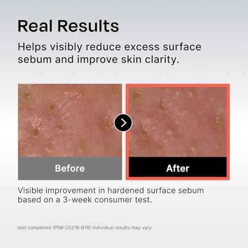 Celladix Sebum Rebalancing Rx 131 Ampoule | Pore Clearing Serum | Tighten Enlarged Pores | Repair Skin Barrier | Rapid Soothing for Daily Use | Oily & Combination Skin| 1.01 Fl Oz