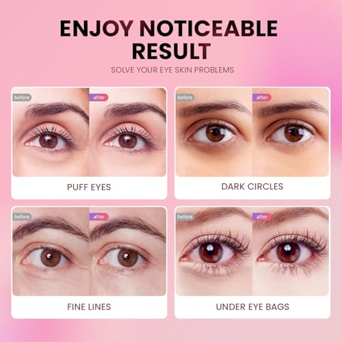 Under Eye Patches (24 Pairs) - Tri-color Glitter Eye Gel Pads for Dark Circles, Puffy Eyes, Under eye Bags, Wrinkles | Natural Collagen Under Eye Mask Patches, Gel Under Eye Patches