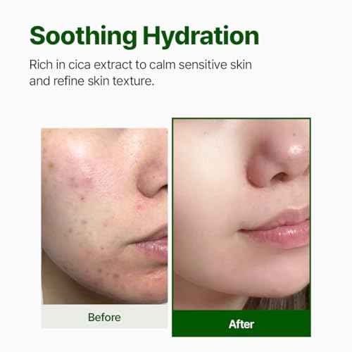 NACIFIC CICA PDRN First Toner 5.07 fl oz 150ml, Centella Asiatica & PDRN for Sensitive Skin, Cooling Spot Toner, Balancing & Soothing Korean Skincare, Stocking Stuffers, Christmas Gifts for Women