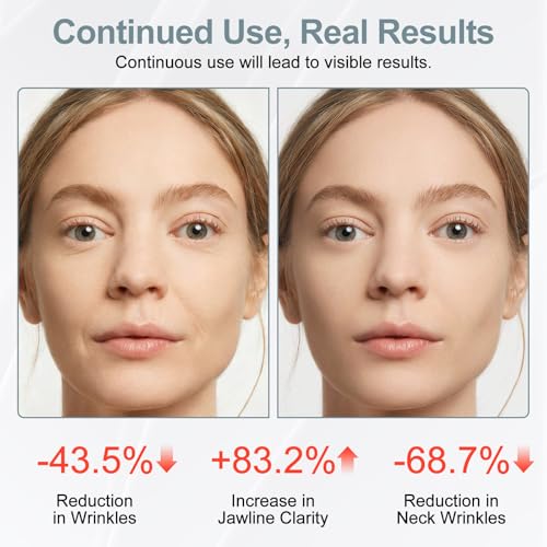 Red Light Beauty Device for Face and Neck, Based on High-end Red and Blue LED Light, Facial Cold and Hot, Vibration Technology, 3 Color Led Face and Neck Beauty Device for Home Use, Pearly White