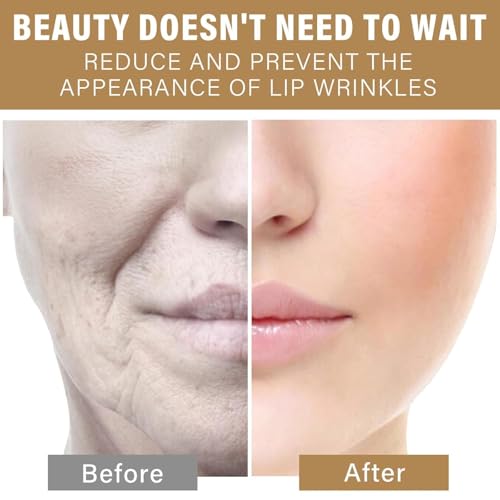 Anti-Wrinkle Lip Patches with Collagen - Silicone Smile Lines